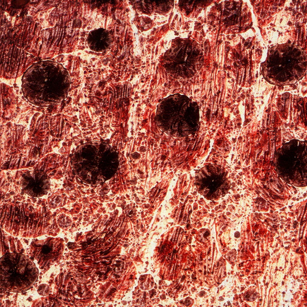 Alloyed Steel Microstructure